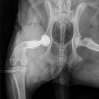 Total Hip Replacement.